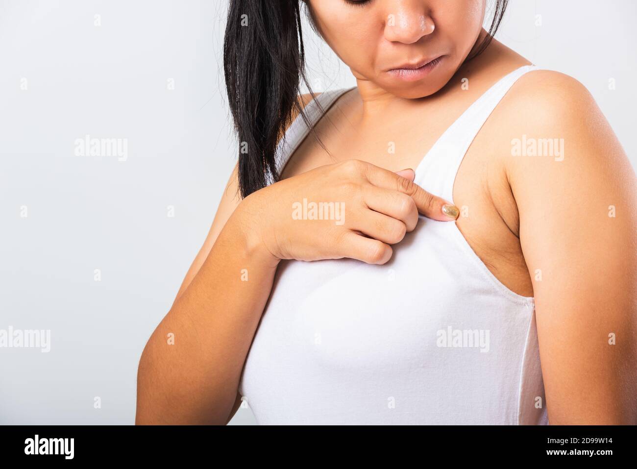 Close up of Asian woman pointing her skin underarm she problem armpit fat  underarm wrinkled skin, problem armpit skin, studio isolated on white  backgr Stock Photo - Alamy