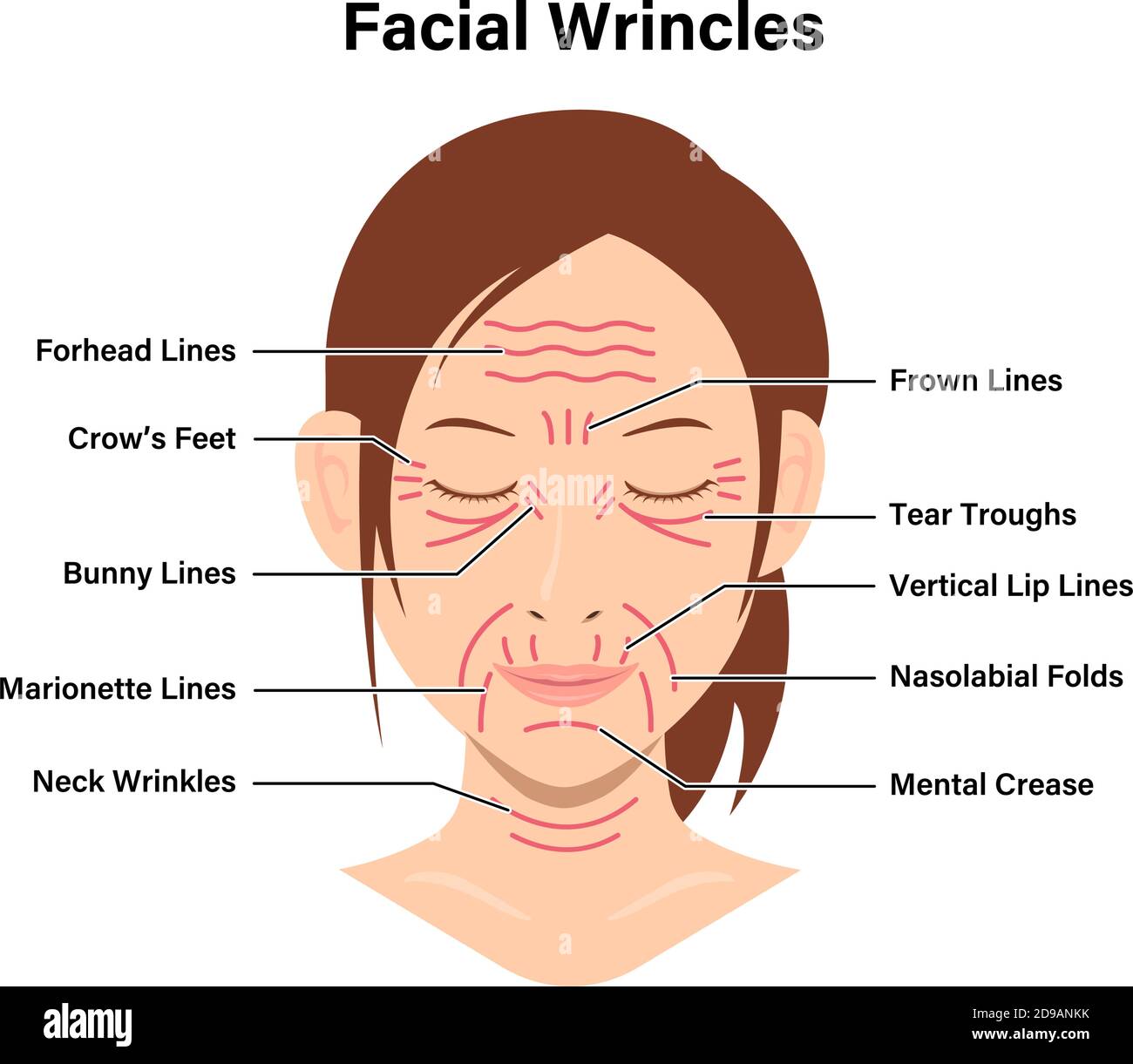 Facial Wrinkles Female Face Vector Illustration Stock Vector Image And Art Alamy 