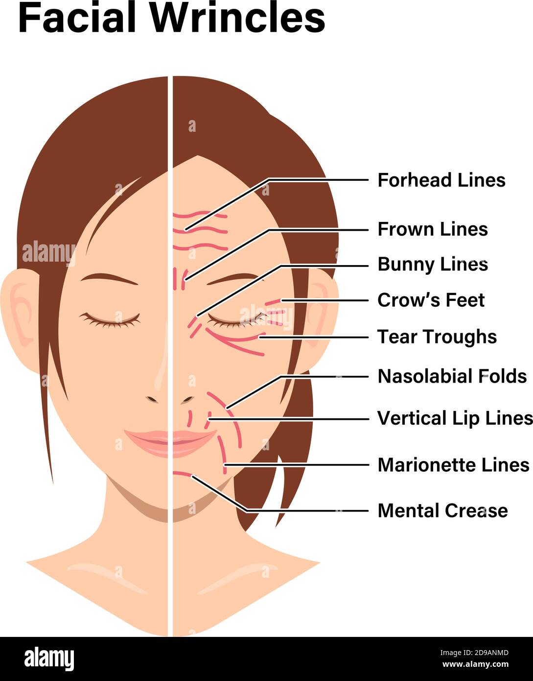 Wrinkles face and wrinkle-free face ( female face ) vector illustration Stock Vector