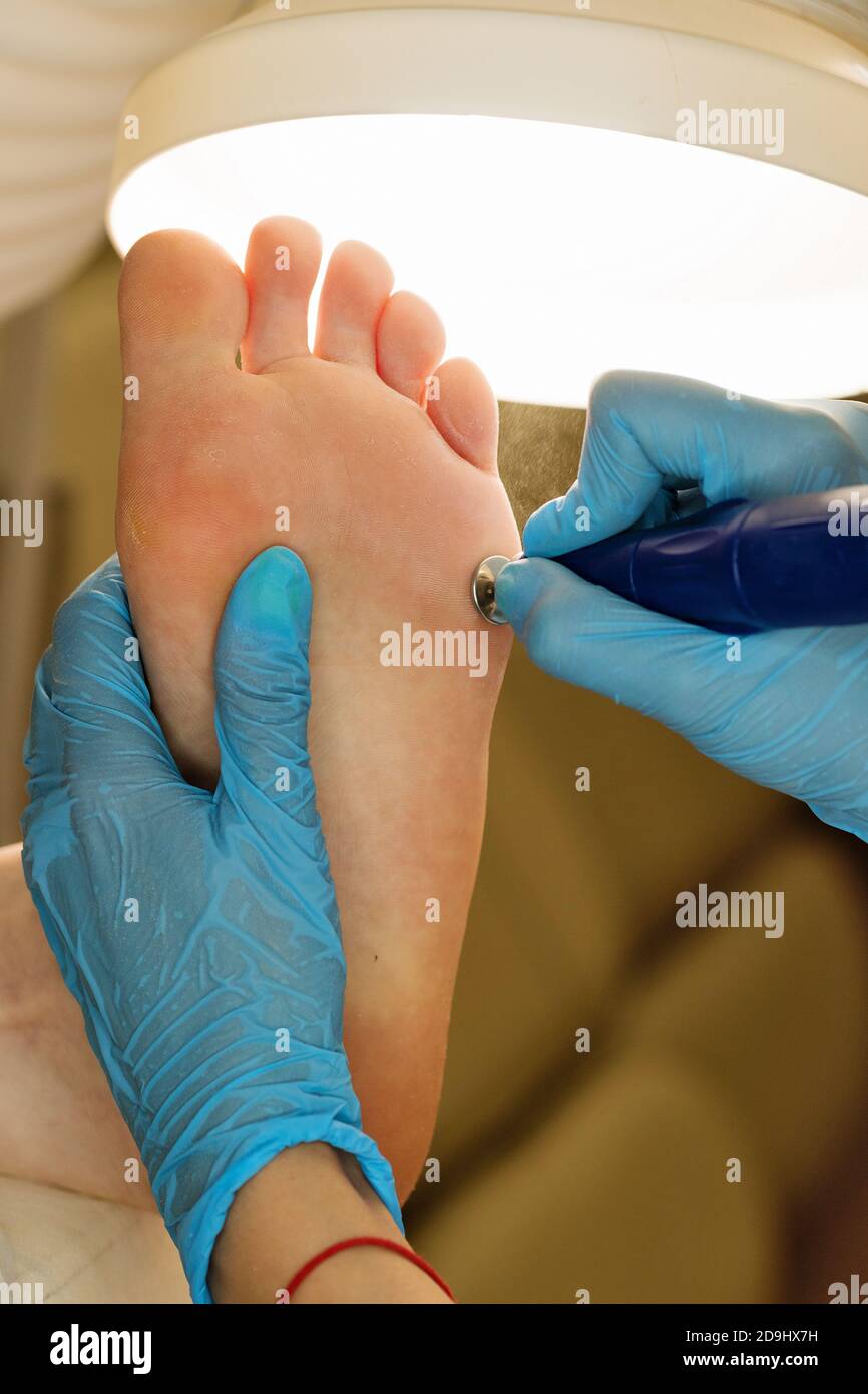 Podiatrist using grinding equipment and making procedure polish for feet hardware pedicure