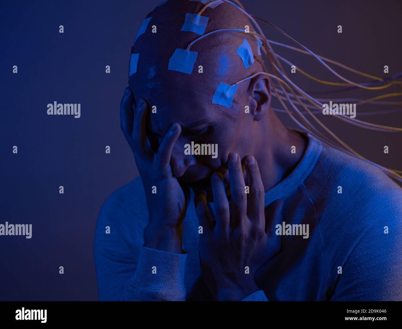 Man with a bald head with wires connected. Fear and anxiety. Examination of the brain, mind control. Stock Photo