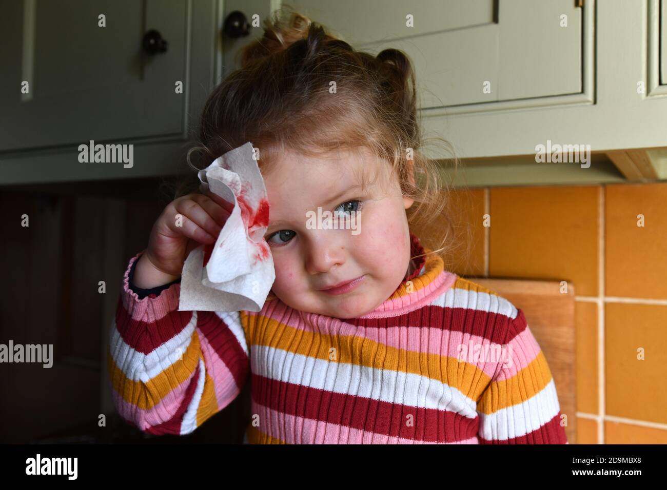 Child young girl nursing an injury after fall at home Stock Photo