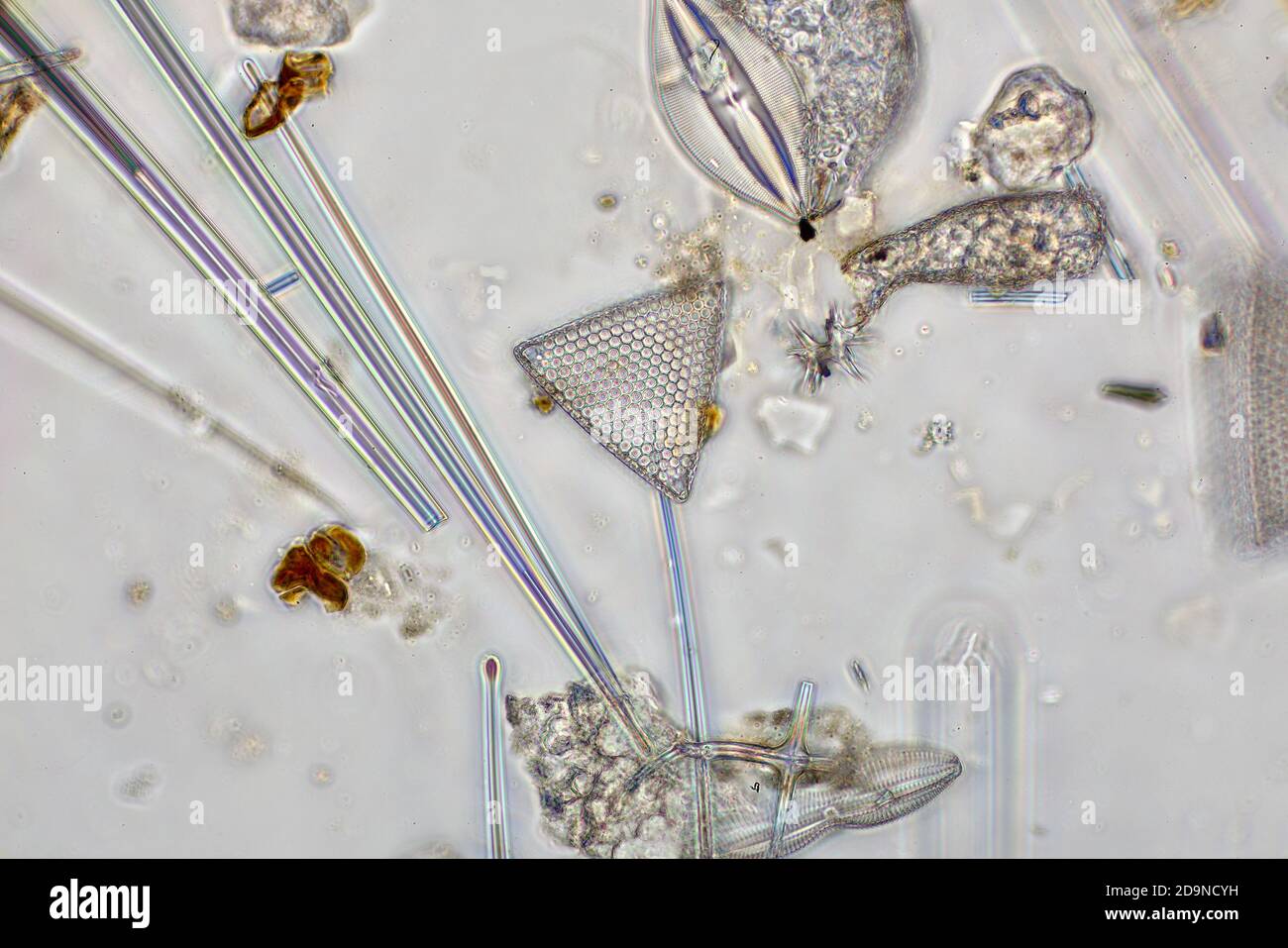 Diatoms from Porto Seguro, Brazil, darkfield photomicrograph Stock Photo