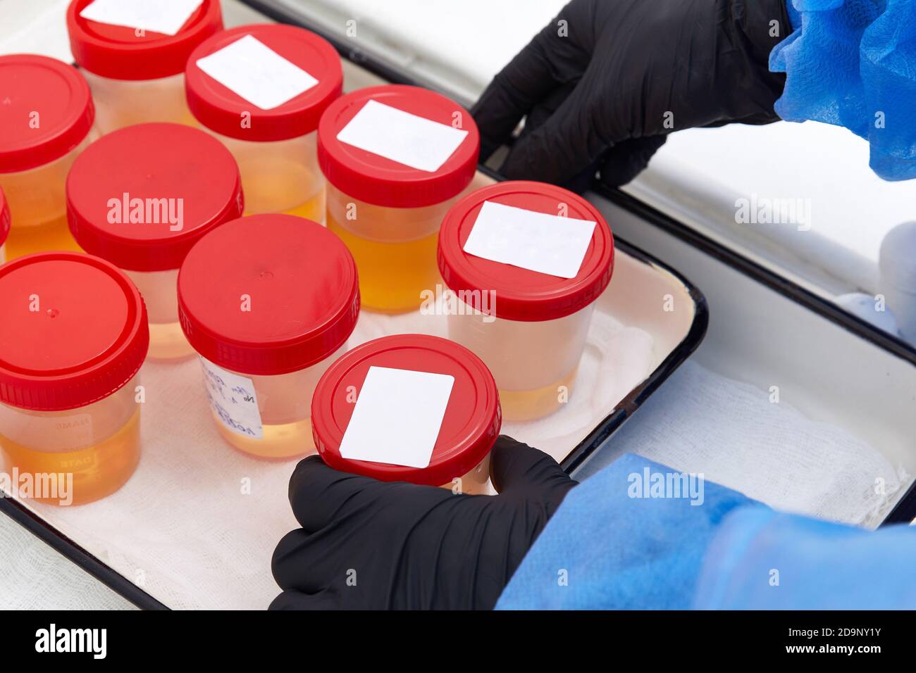 Urine analysis in the laboratory. Medical urine test. Urine sample for laboratory analysis Stock