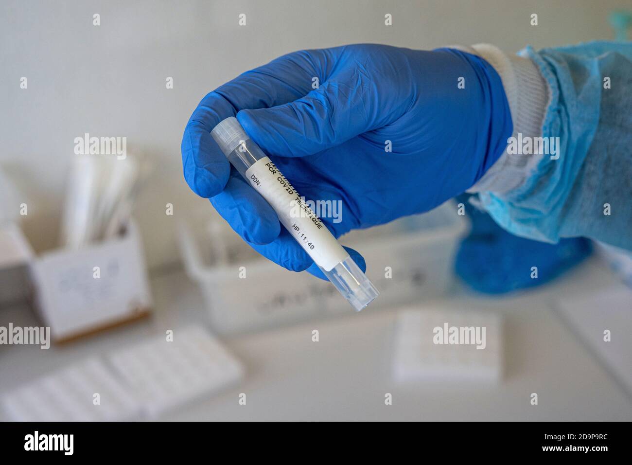 Coronavirus COVID19 specimen collecting equipment nasal and oral