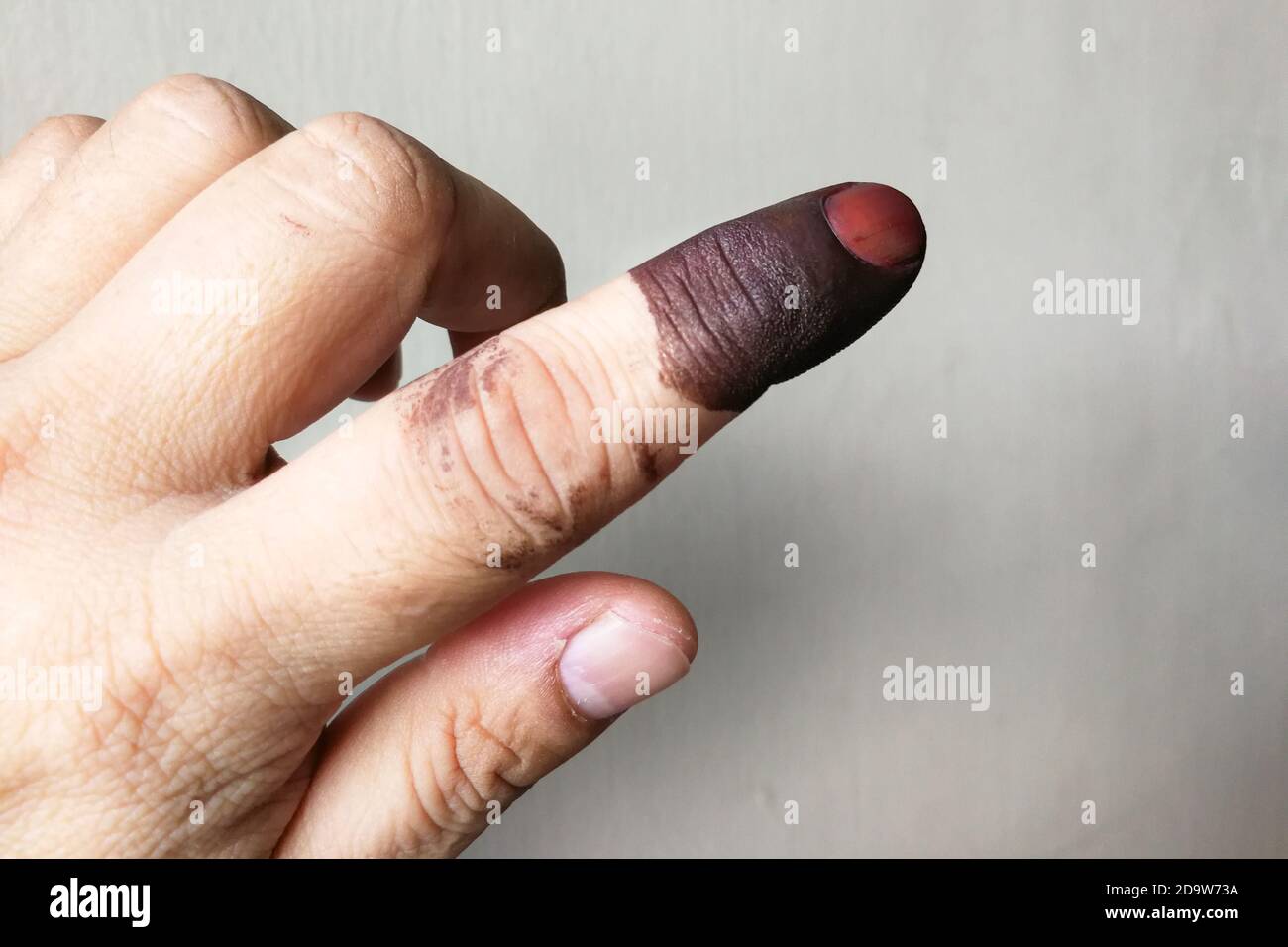 Index finger with indelible ink stain after voting in election Stock Photo  - Alamy