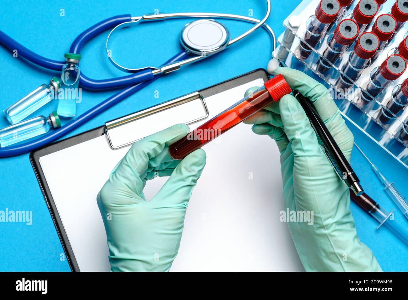 lab technician assistant or doctor holding a blood sample in test tube ...