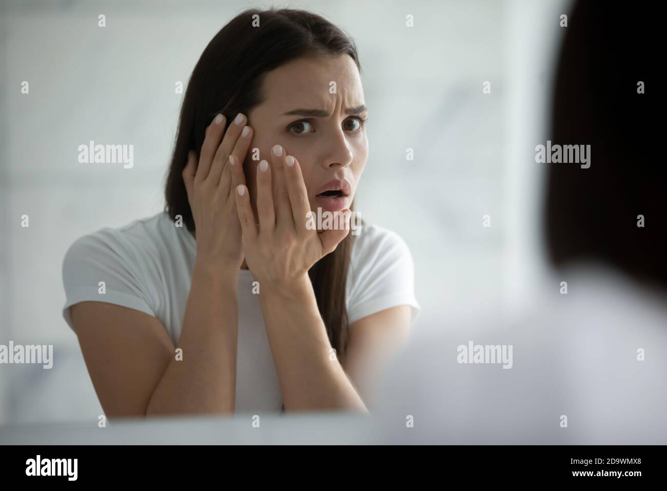 Anxious girl teenager troubled by bad condition of facial skin Stock Photo