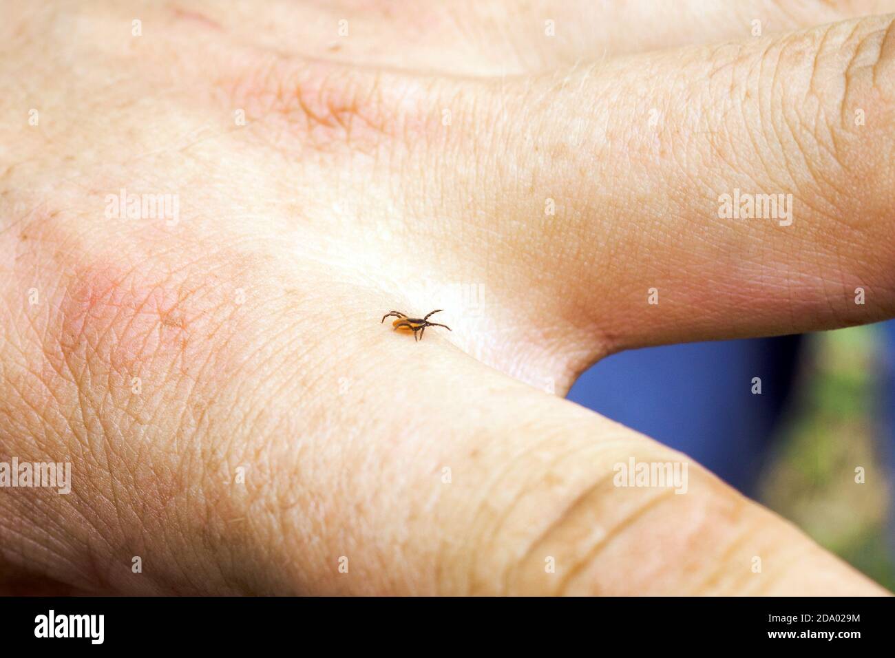 Hard mite, scale tick of family Ixodidae on human hand. Carrier of pathogens that can cause human disease Stock Photo