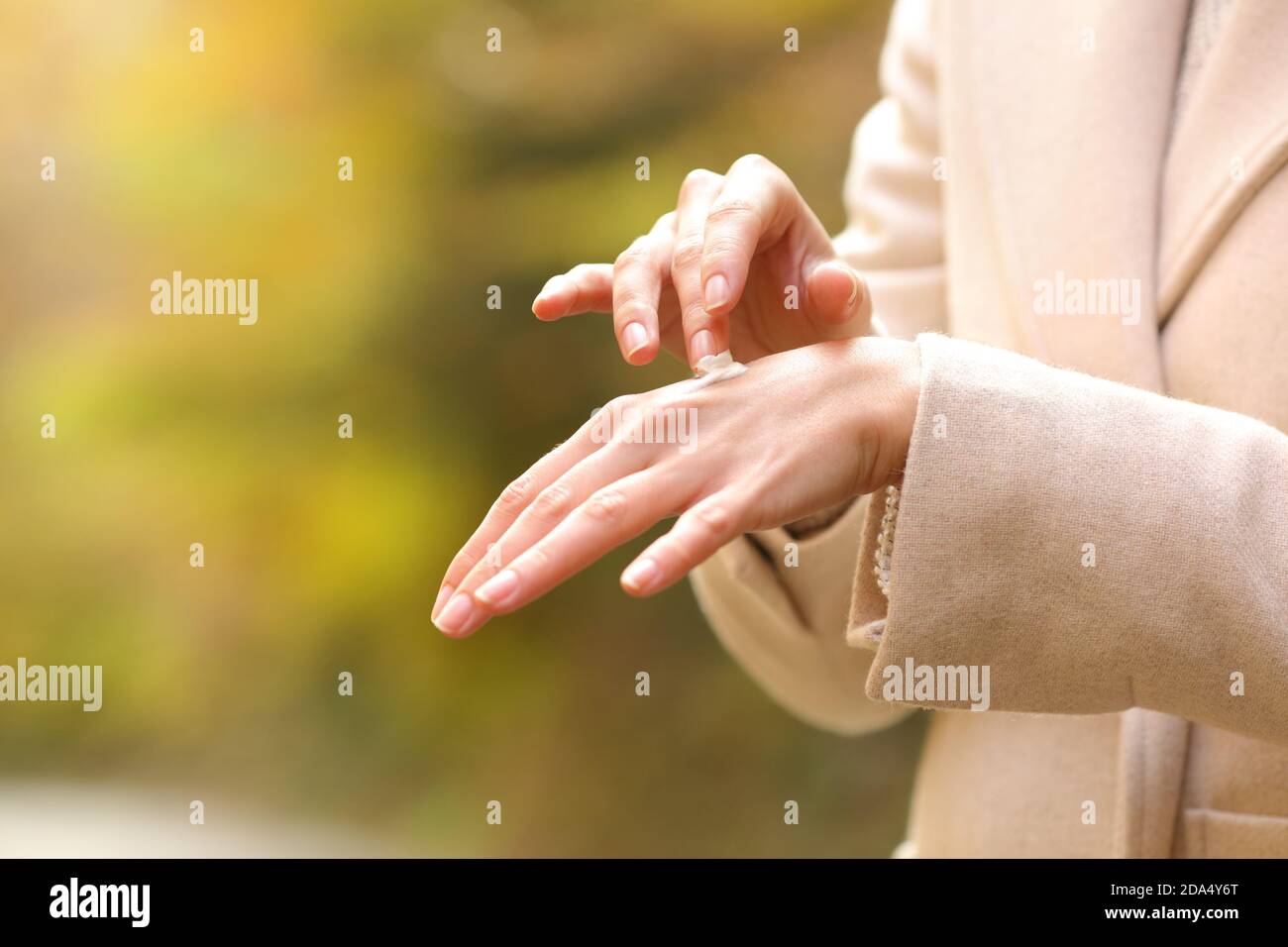 Close up of dry woman hands in autumn applying moisturizer cream in a park Stock Photo