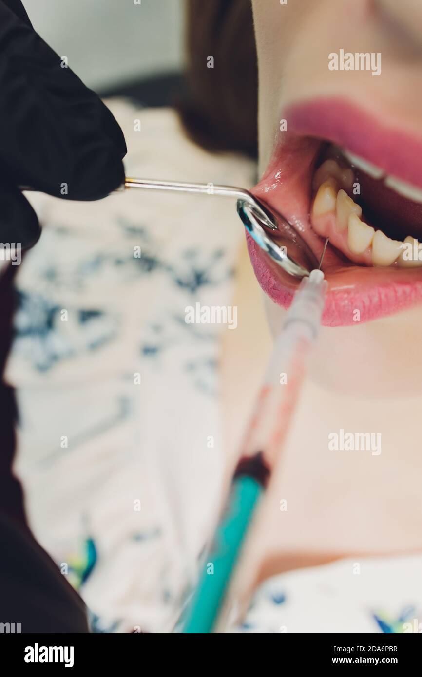 Dentist giving injection for anesthetizing his patient Stock Photo Alamy