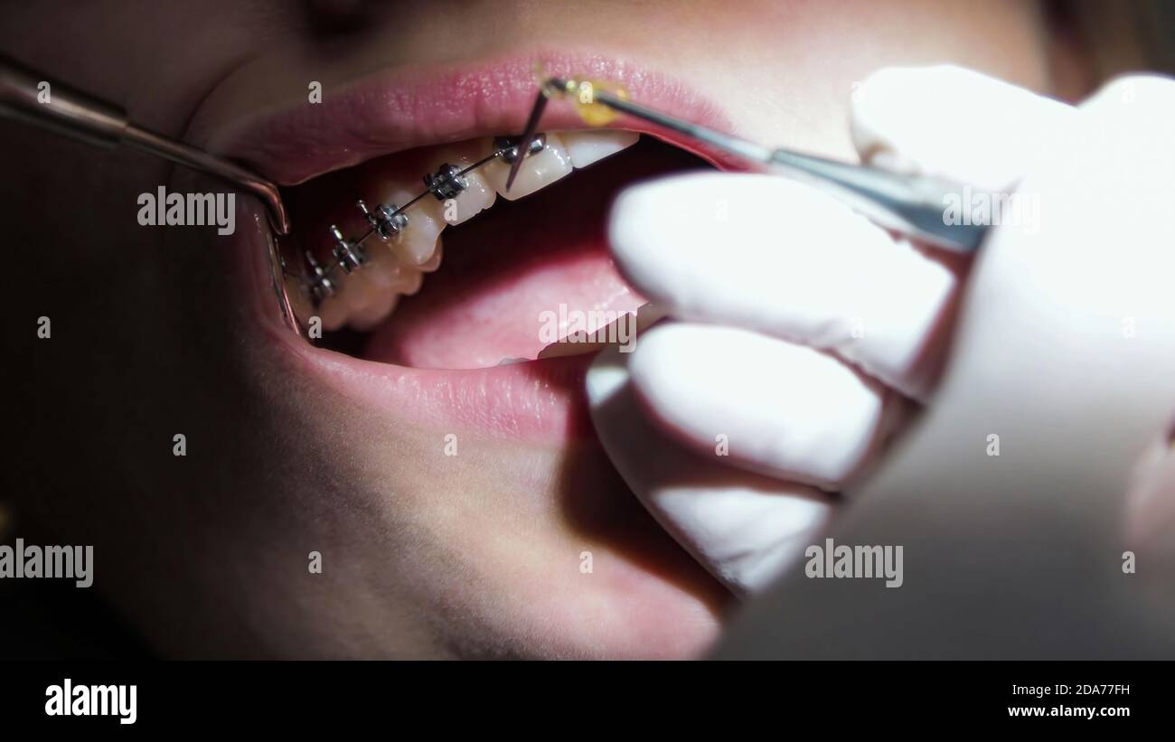 Elastic tiles hires stock photography and images Alamy