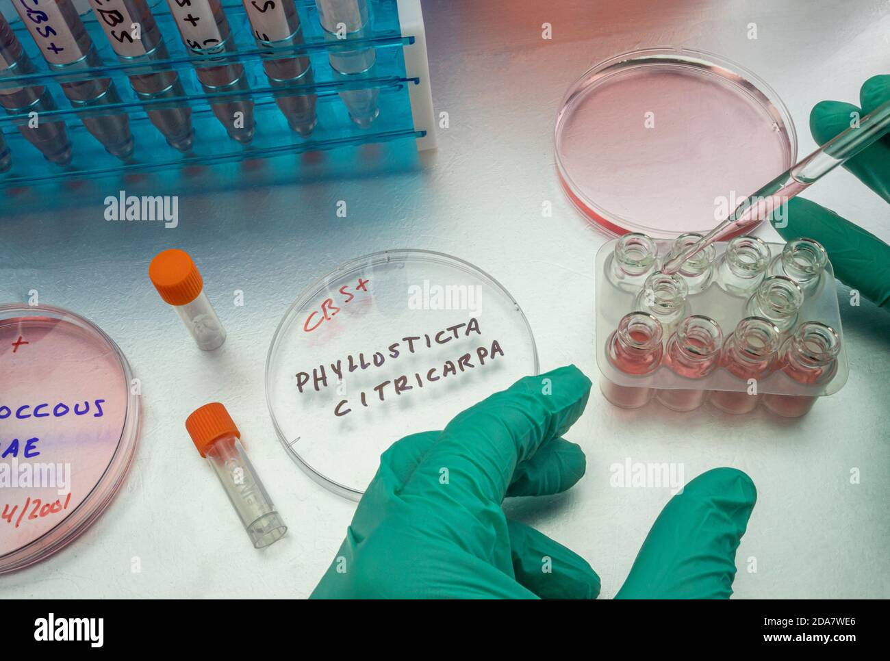 Samples of a tiny fungus in oranges called Phyllosticta citricarpa or black spot, it is a pest especially present in South Africa, petri dish contains Stock Photo