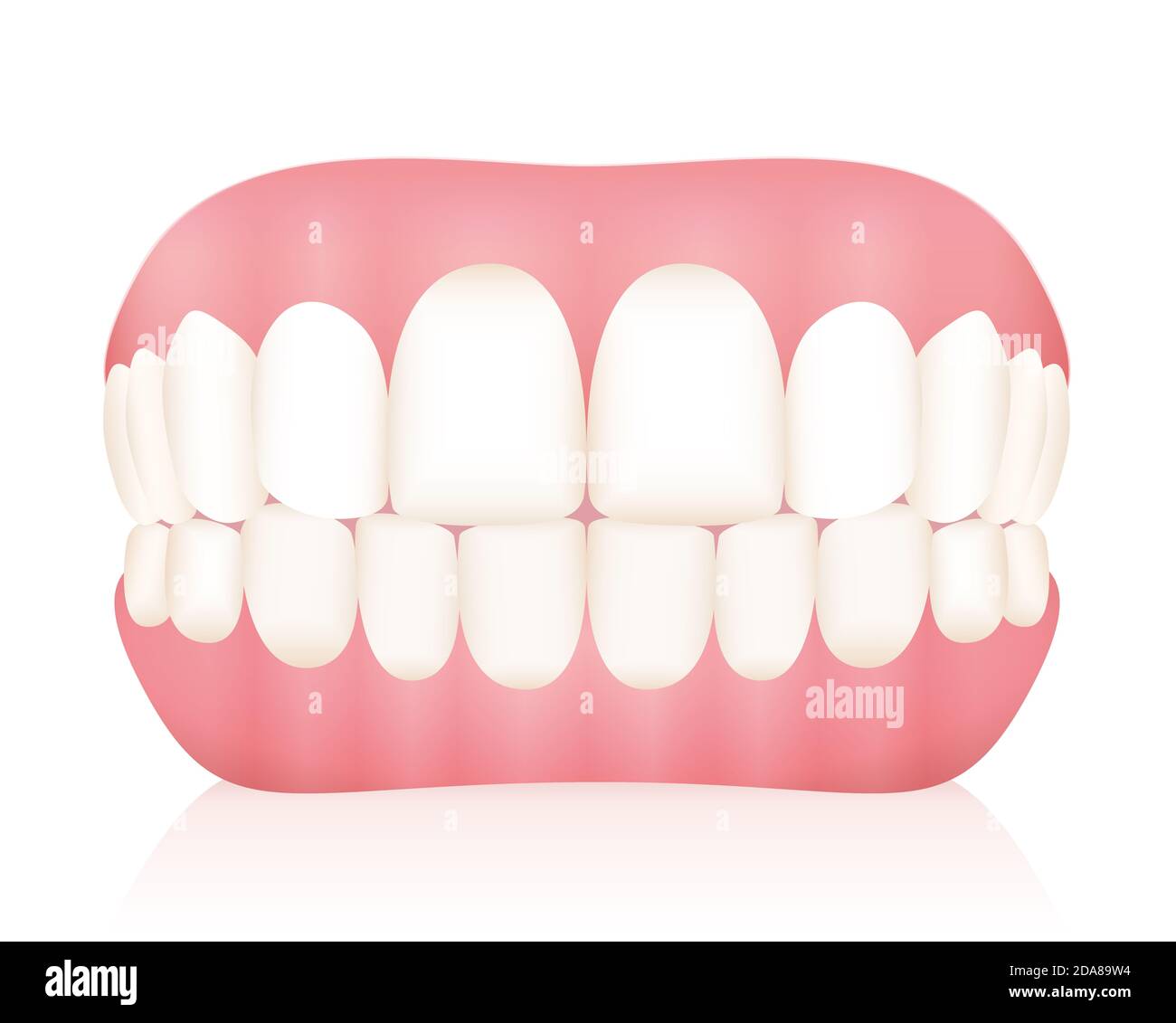Dentures. False teeth - illustration on white background. Stock Photo