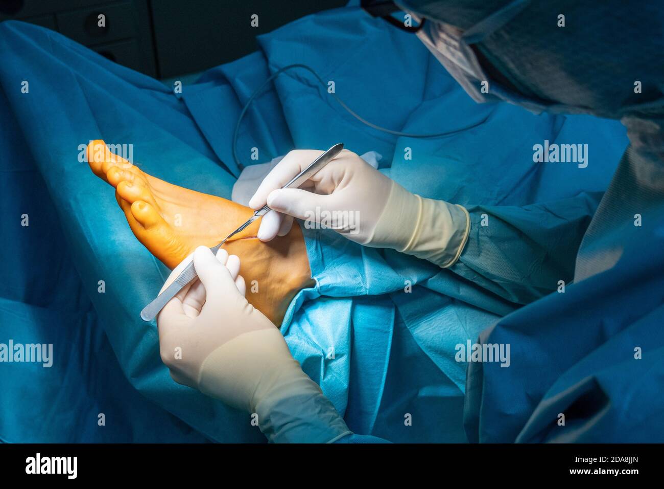 surgeon makes an incision on one foot with a scalpel Stock Photo Alamy