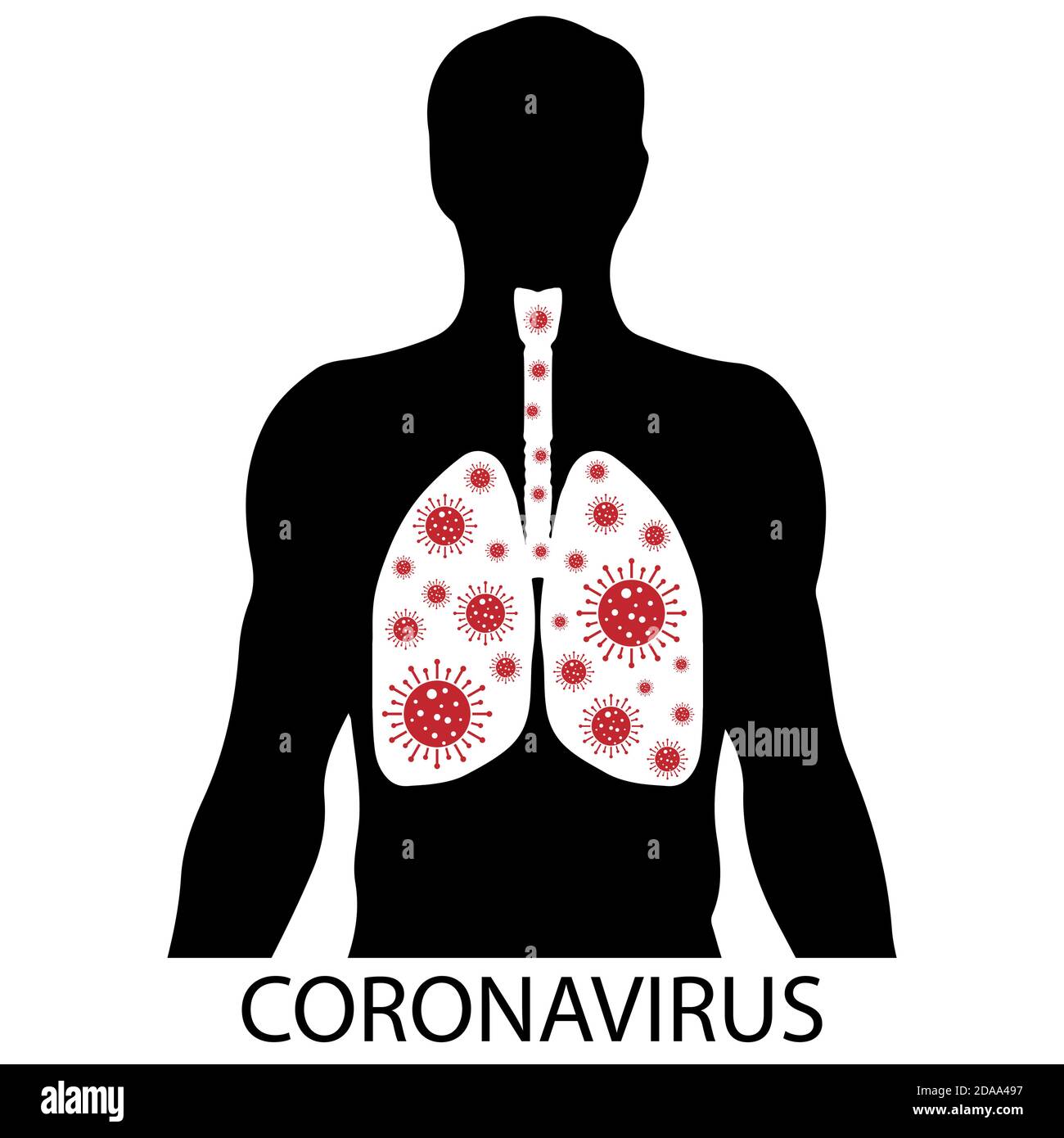 Virus quarantine. MERS-Cov middle East respiratory syndrome. Human lungs infected with the virus. Respiratory system. Disease within a person Stock Vector