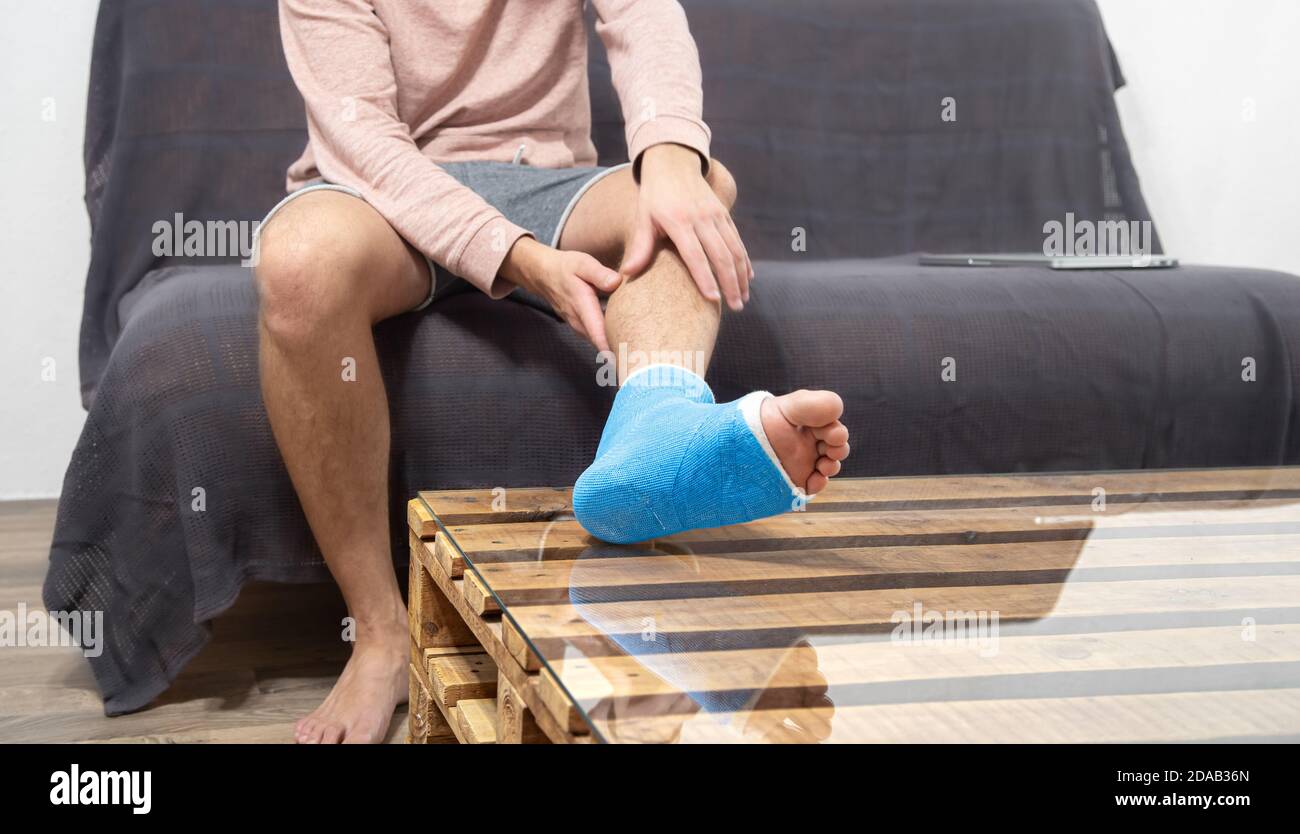 Man with broken leg in cast on couch. Heel or foot have broken bone with put on a cast, medical concept background. Stock Photo