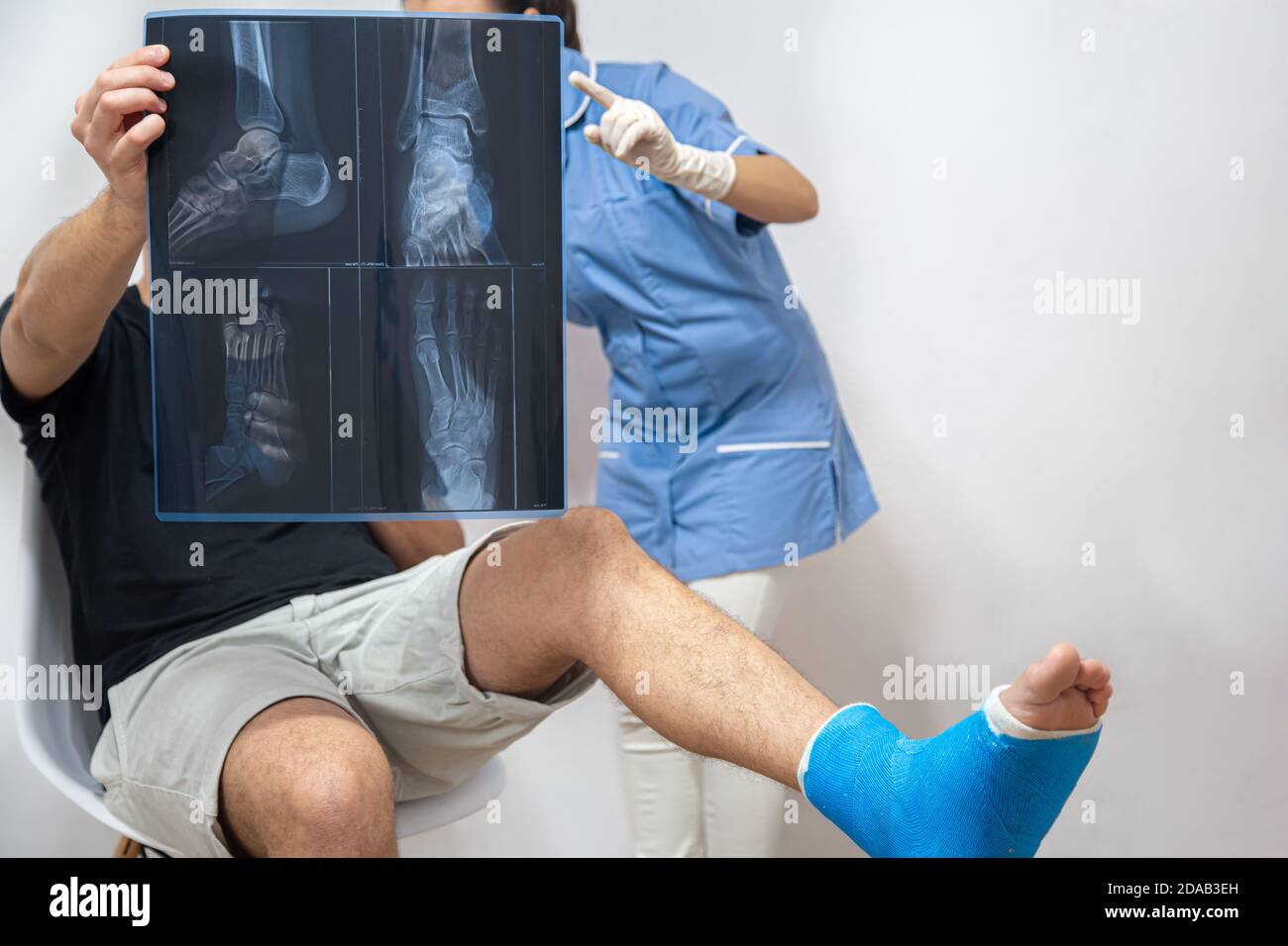 Broken leg x ray isolated hi-res stock photography and images - Alamy