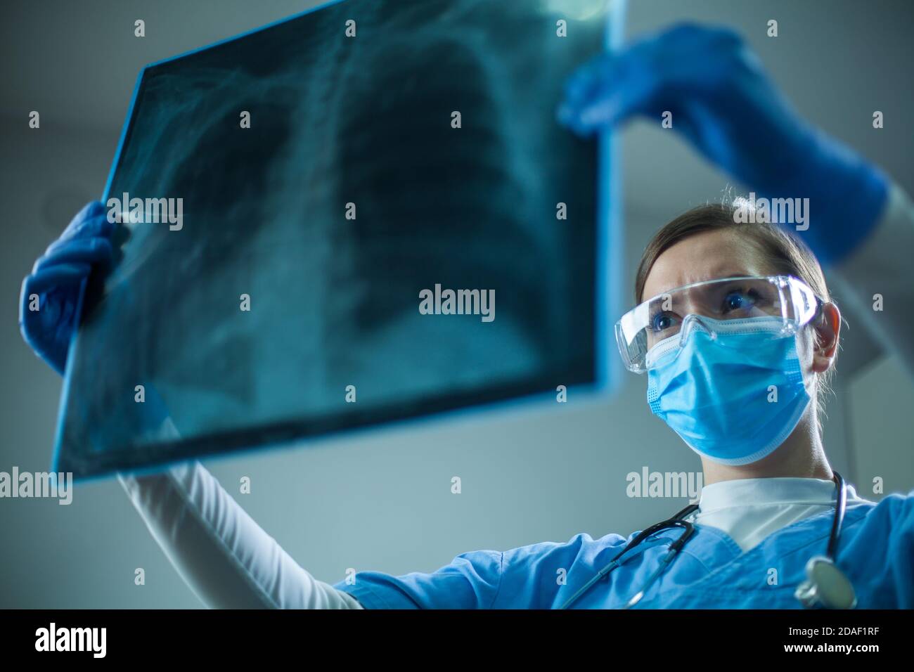 Female pulmonologist or oncologist holding chest X-ray scan,inspecting COVID-19 patient lungs,wearing PPE uniform,Coronavirus acute respiratory virus Stock Photo
