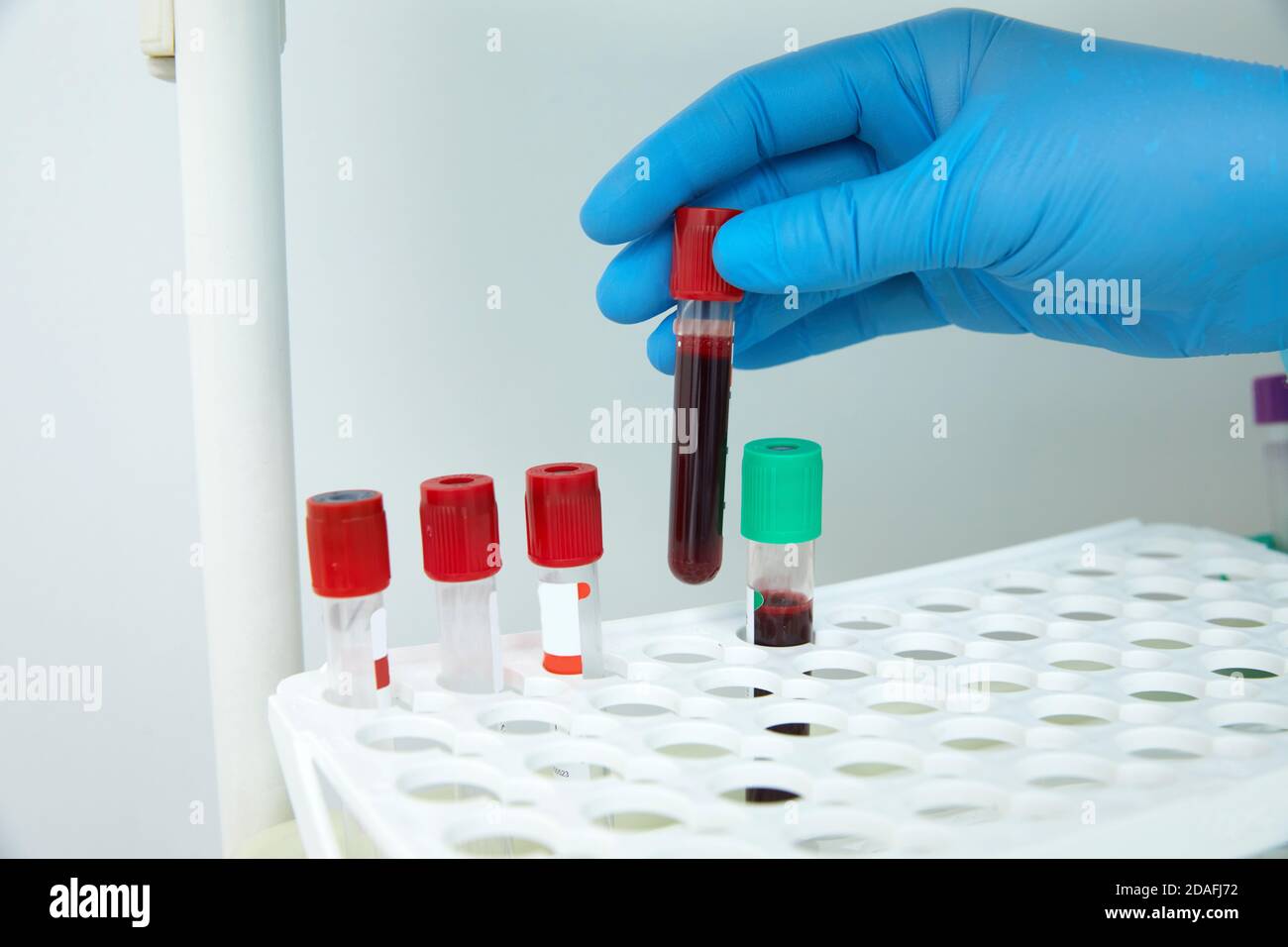 Scientist working with blood sample in laboratory Stock Photo