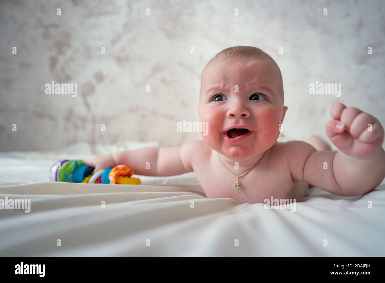 Close-up of a baby with skin Allergy lying on the bed. Close-up of a baby's face with skin Allergy. the baby is crying Stock Photo