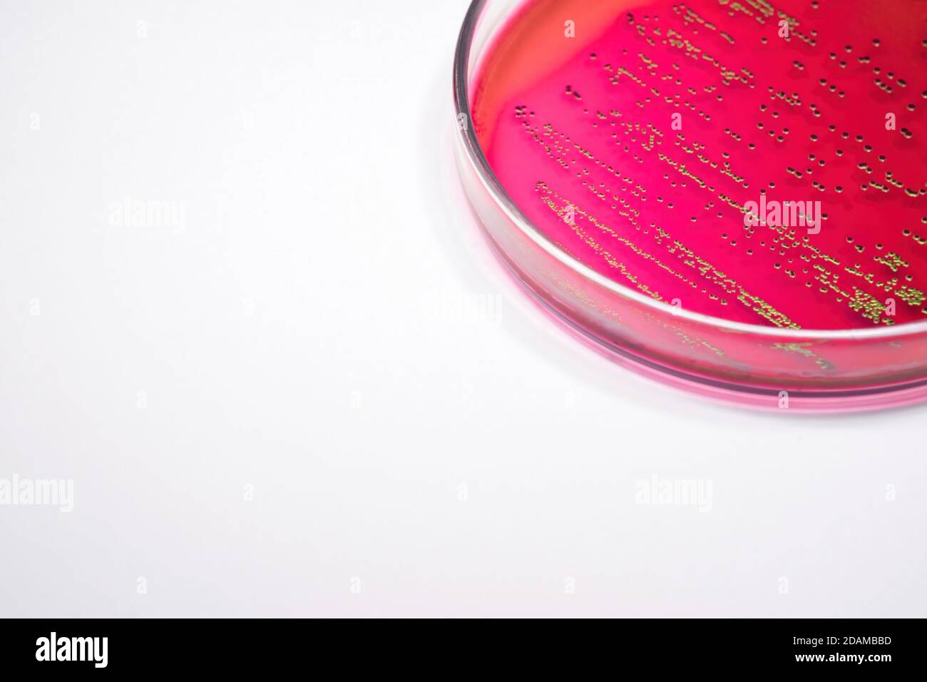 Escherichia coli bacteria on blood agar selective media. Stock Photo