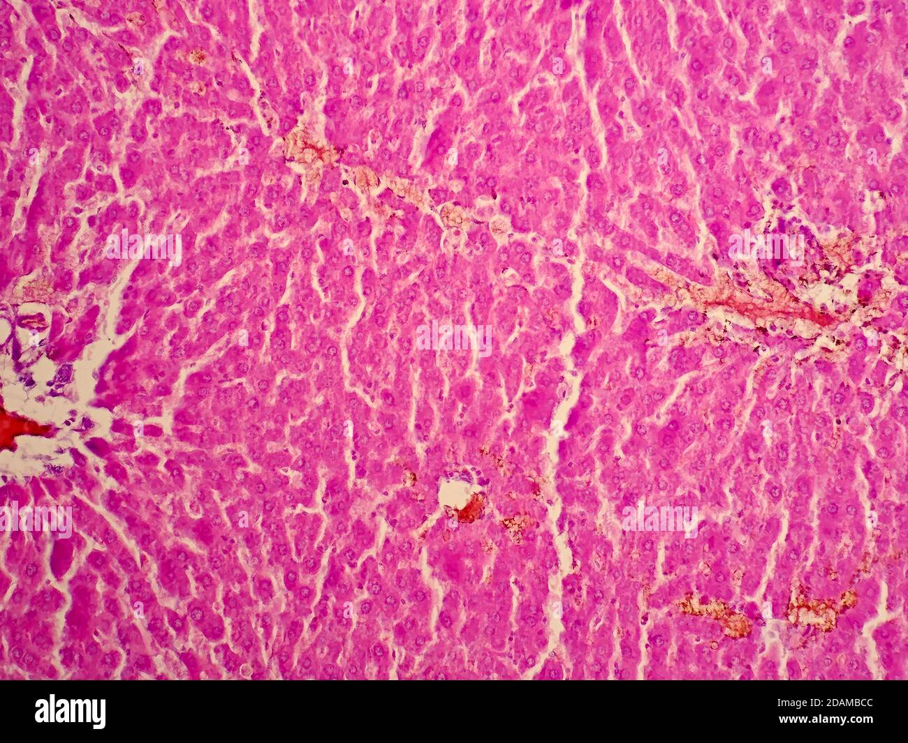 Human liver tissue, light micrograph Stock Photo Alamy