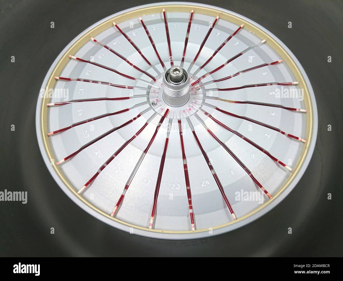 Haematocrit centrifuge used to determine volumetric proportions of