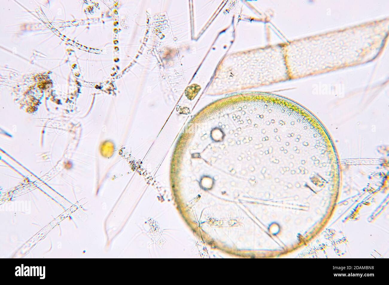 Marine plankton, light micrograph. Stock Photo