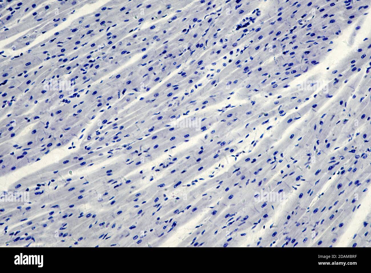 Cardiac muscle, light micrograph. Stock Photo