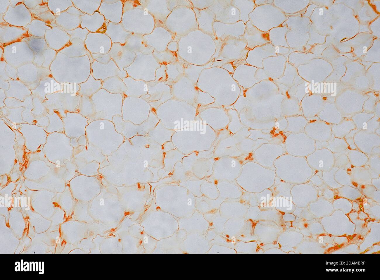 Human fat cells, light micrograph. Stock Photo