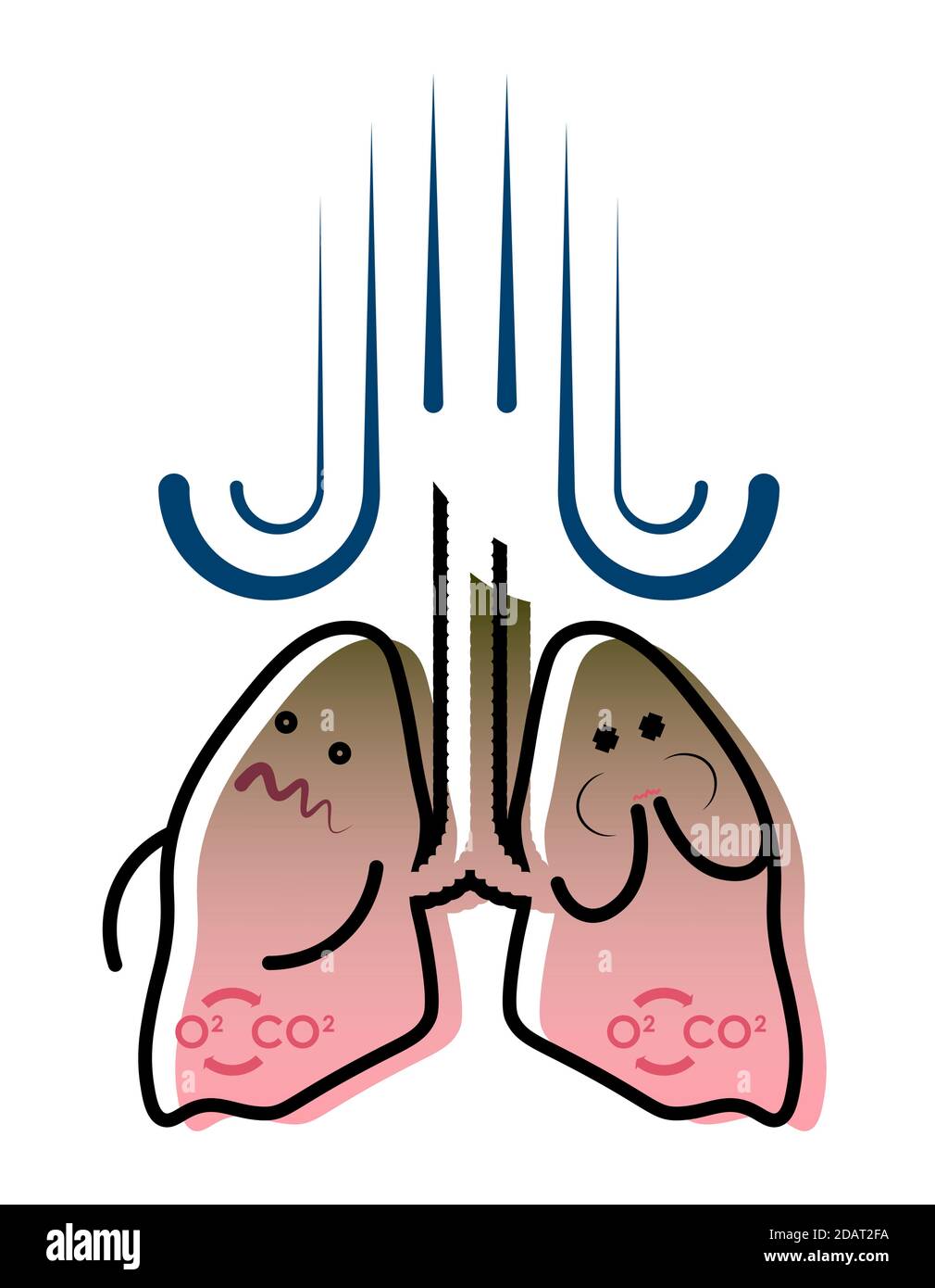 illustration, smokers lungs, nausea and vomiting, feeling sick