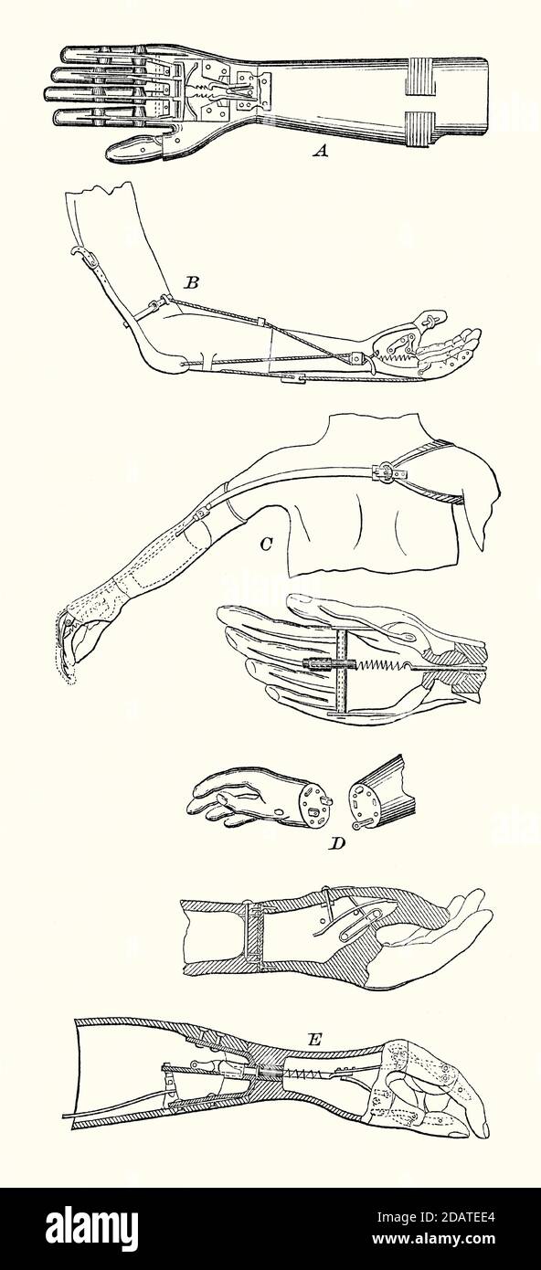 An old engraving of the various prosthetic hands and arms used in the 1800s. It is from a Victorian mechanical engineering book of the 1880s. Illustrations show the differently designed prosthetics used to aid clasping, flexing and holding. Some of these were operated by other parts of the body – C shows two views of a ‘Selpho’ arm – a spring controlled by the opposite shoulder enables hand movements. Stock Photo