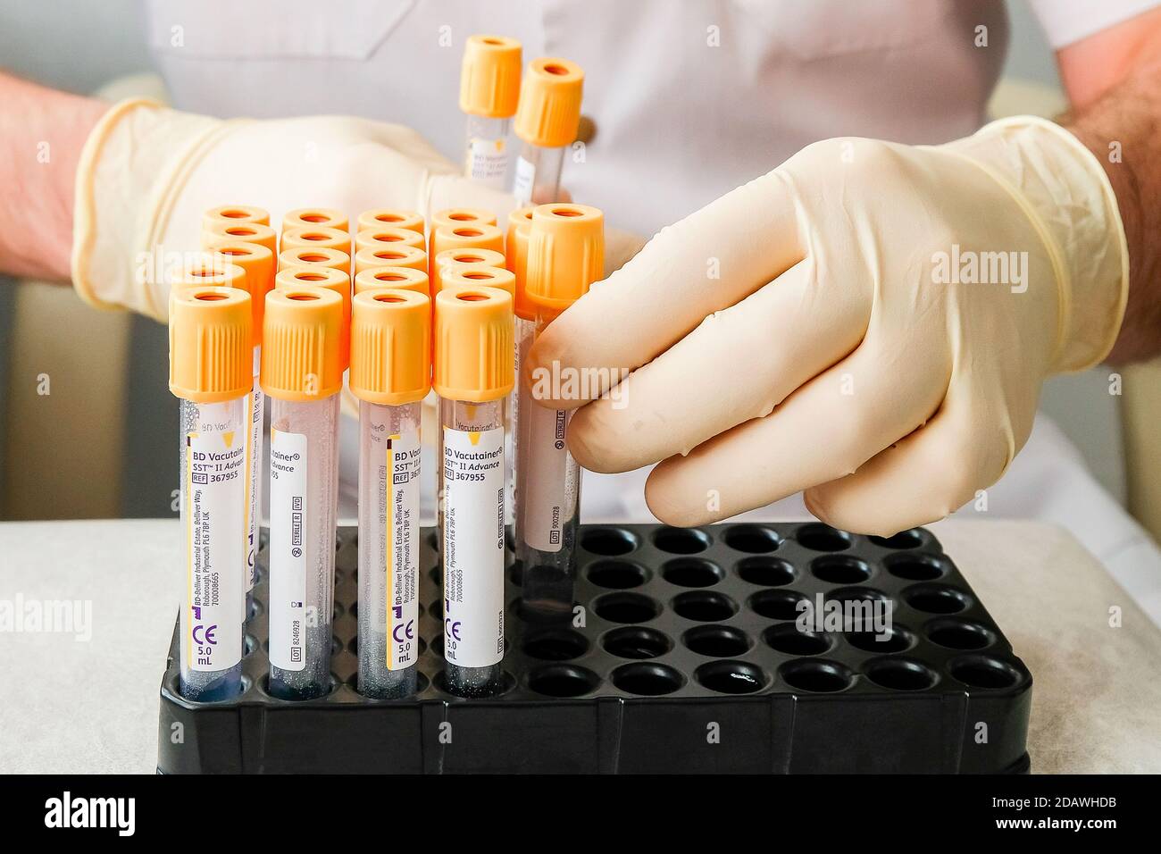Medical vacuum tubes with colored caps in a stand. Nurse work in the  laboratory Stock Photo - Alamy, image size:1300x956