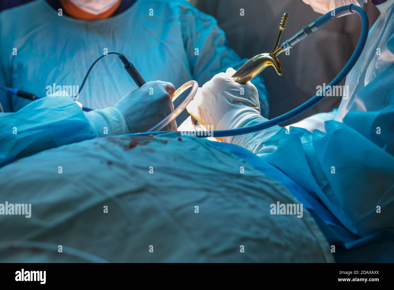 Surgeons hands with tools during surgery closeup Stock Photo