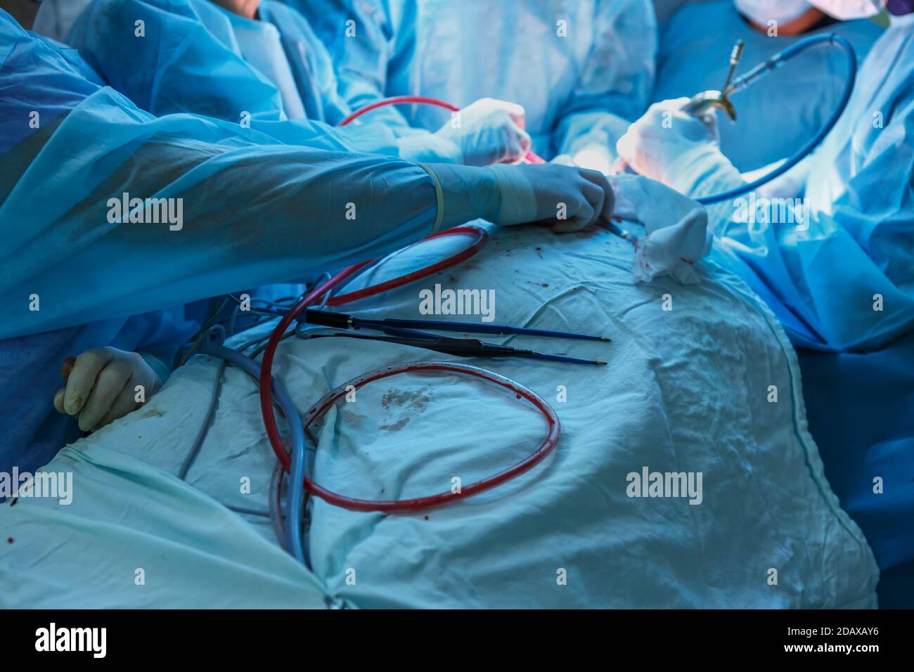 Surgeons hands with tools during surgery closeup Stock Photo