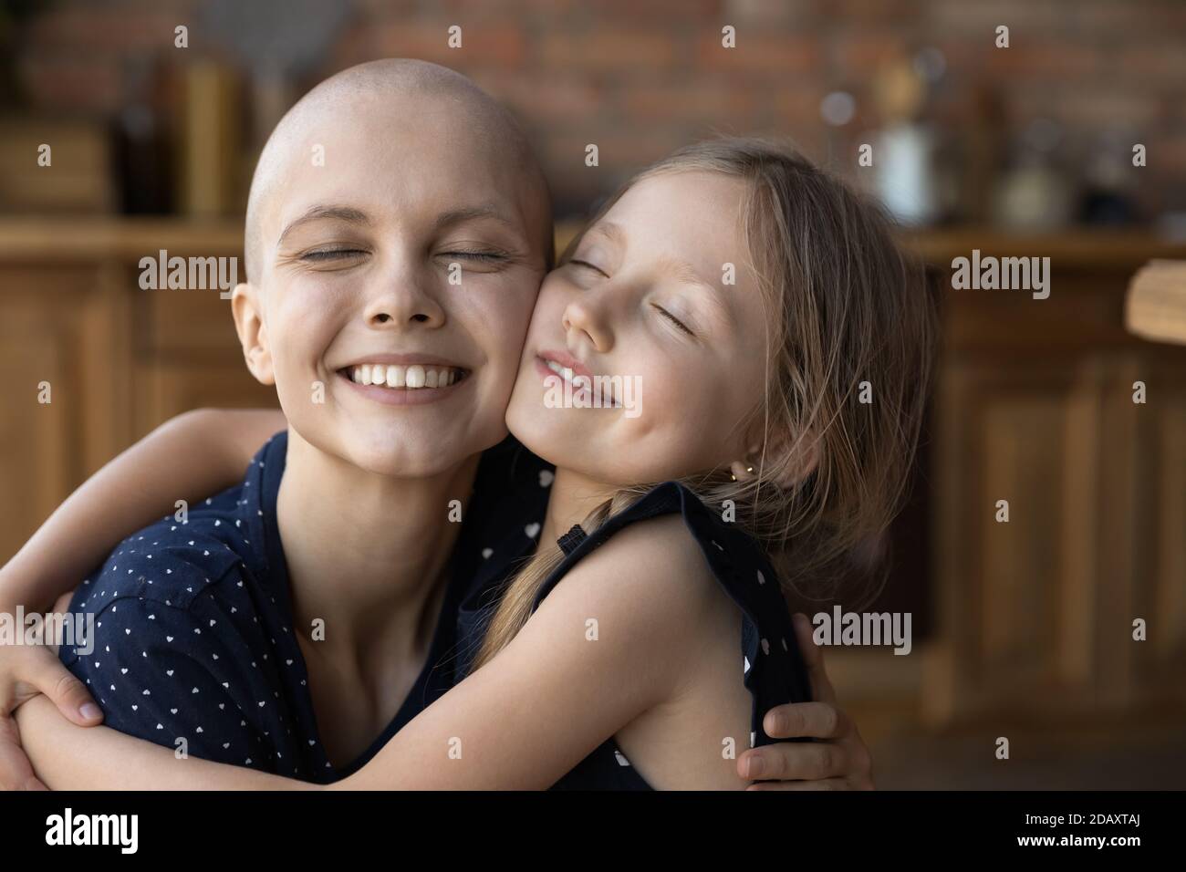 Affectionate little daughter cuddling beloved sick mommy suffering from cancer Stock Photo