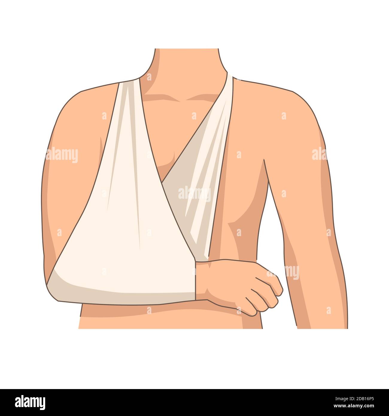 Bandage hand injury arm trauma bandaging medicine Stock Vector Image & Art Alamy