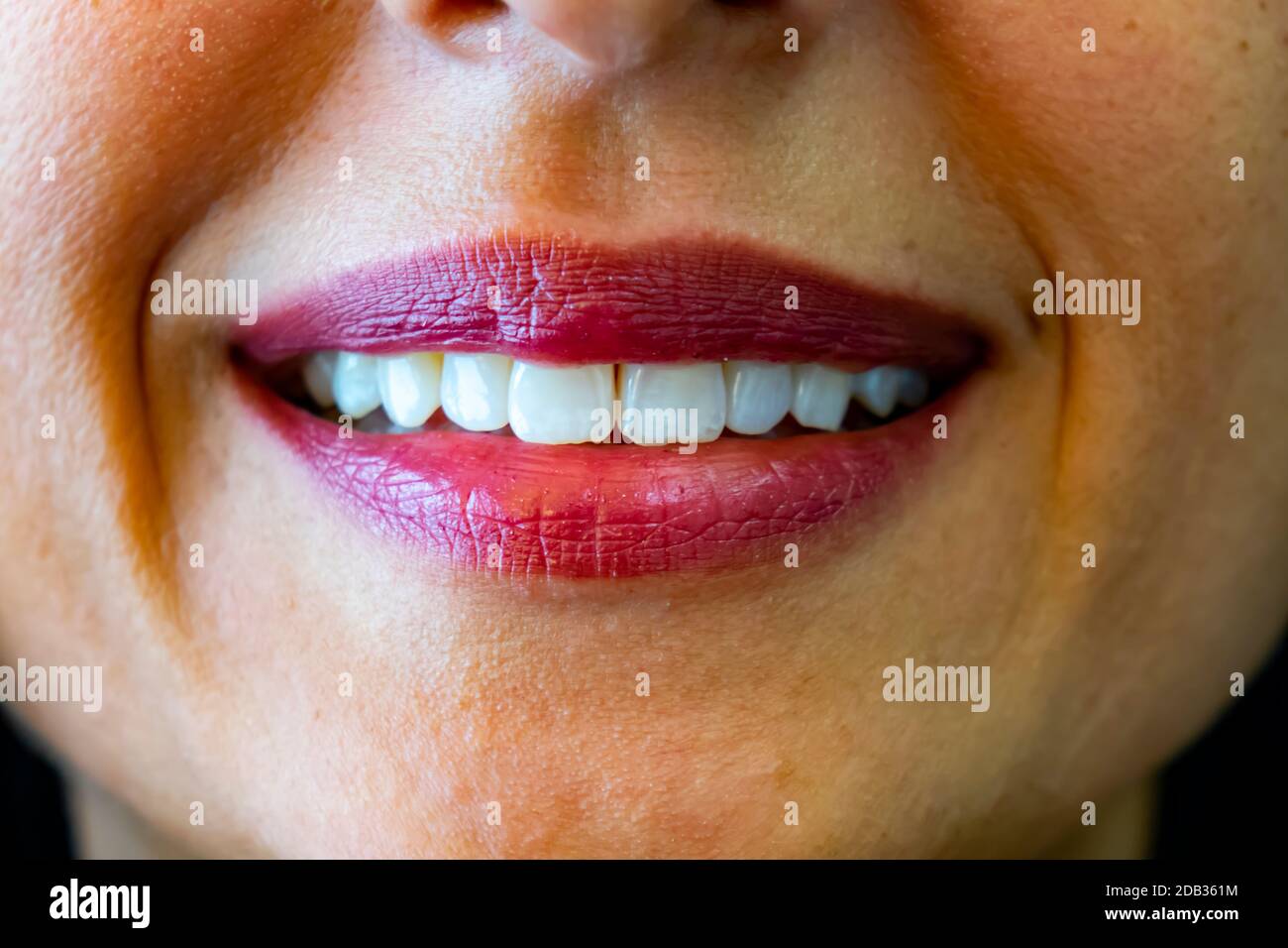 young woman's smile and a white teeth smile Stock Photo