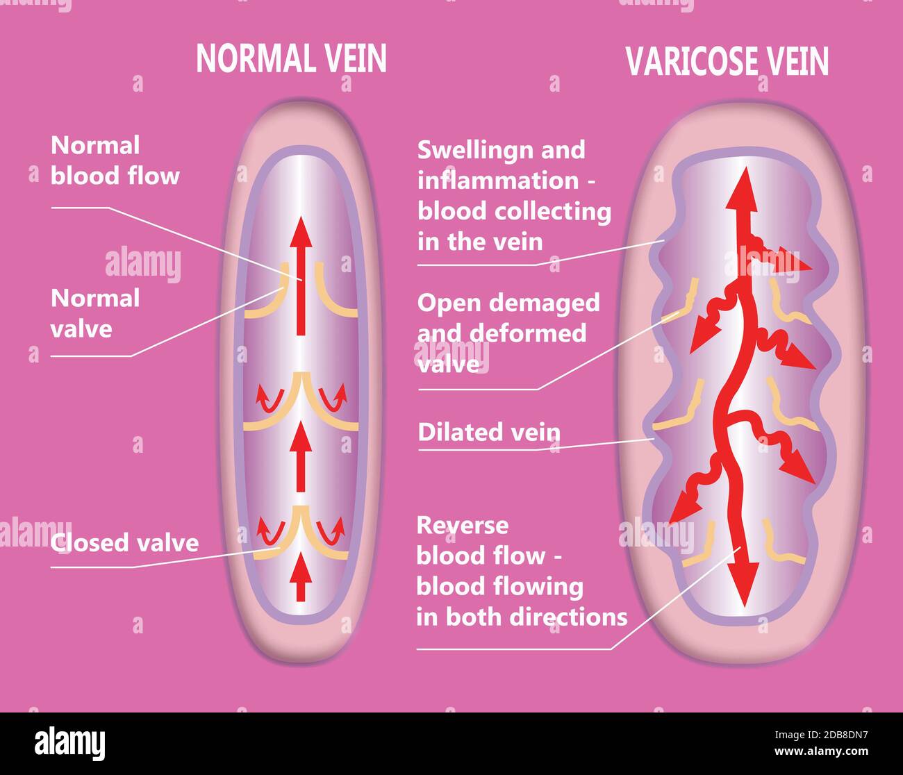 Structure venous system hi-res stock photography and images - Alamy