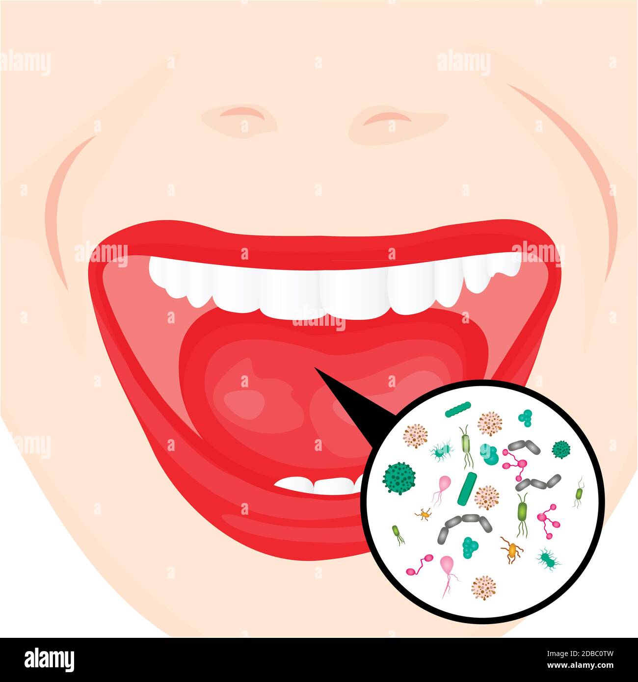 Bacterial overgrowth in a mouth. flu, cold, other contagious diseases