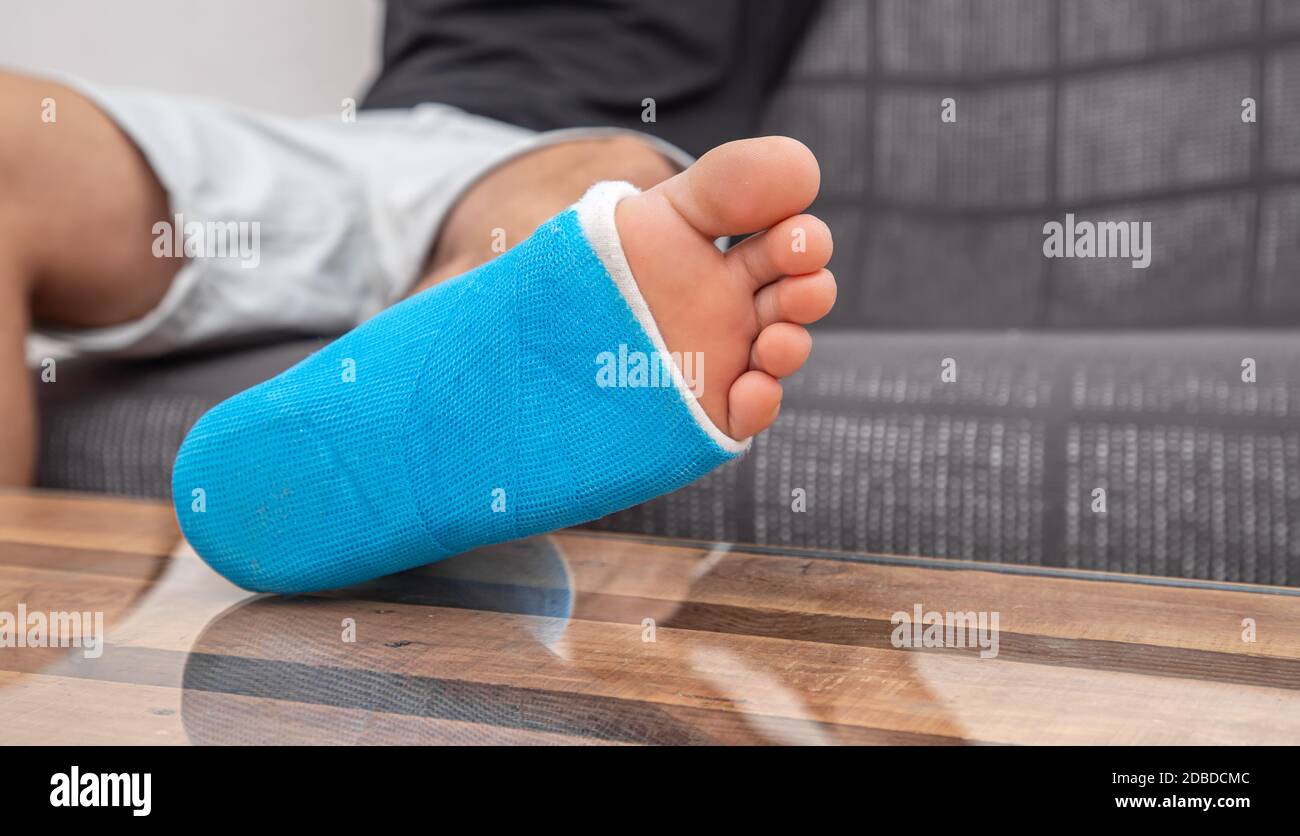 Man with broken leg in cast on couch at home. Sports injury concept
