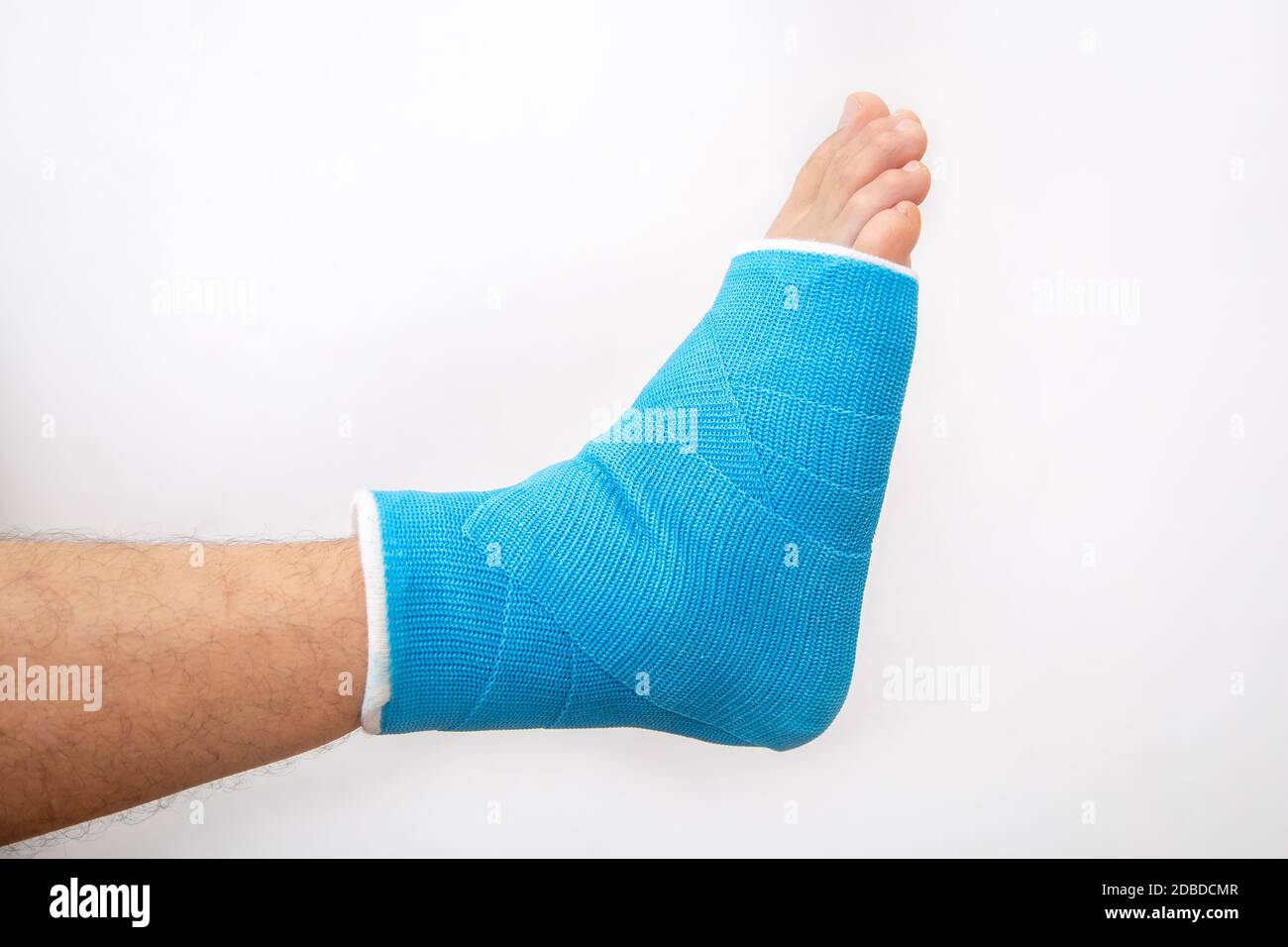 Blue splint ankle. Bandaged leg cast on male patient on white