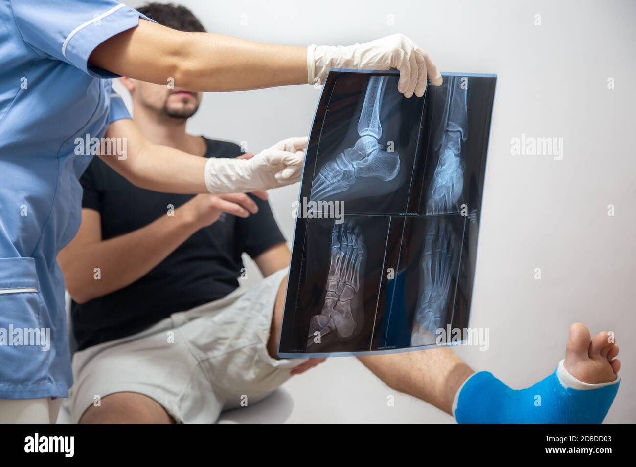 Lower leg fracture x ray hi-res stock photography and images - Alamy