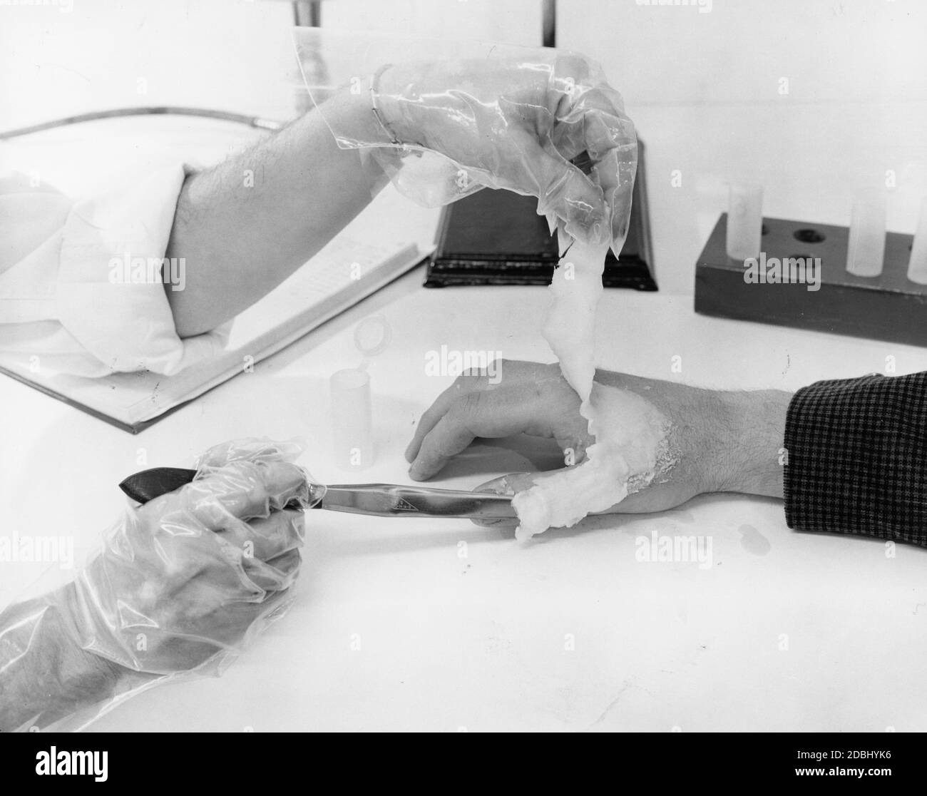 To determine if a suspect has recently fired a gun, gunpowder residue can be removed from the suspect's hand with a paraffin cast, which is analyzed by a new crime fighting technique called neutron activation analysis, no location, 9/8/1964. (Photo by General Dynamics/United States Information Agency/RBM Vintage Images) Stock Photo
