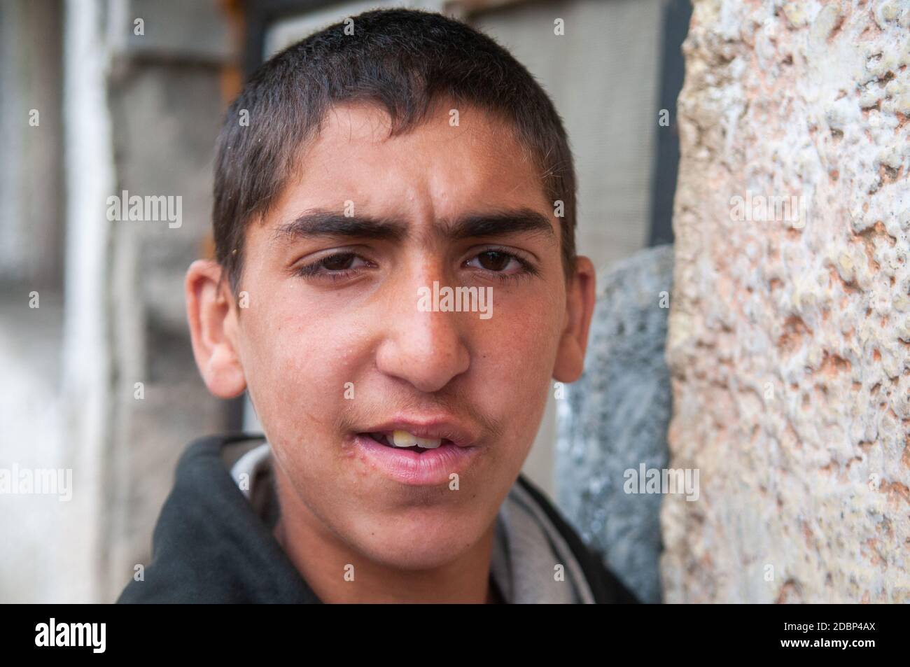 5/16/2018. Lomnicka, Slovakia. Roma community in the heart of Slovakia, living in horrible conditions. Portrait of adolescent. Stock Photo