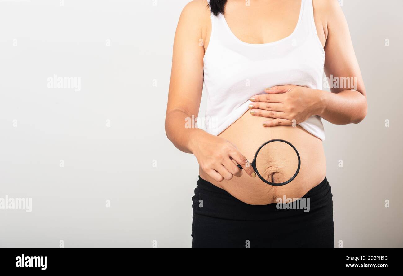 Close up of Asian mother woman use magnifying glass show stretch mark loose lower abdomen skin she fat after pregnancy baby birth isolated on white ba Stock Photo