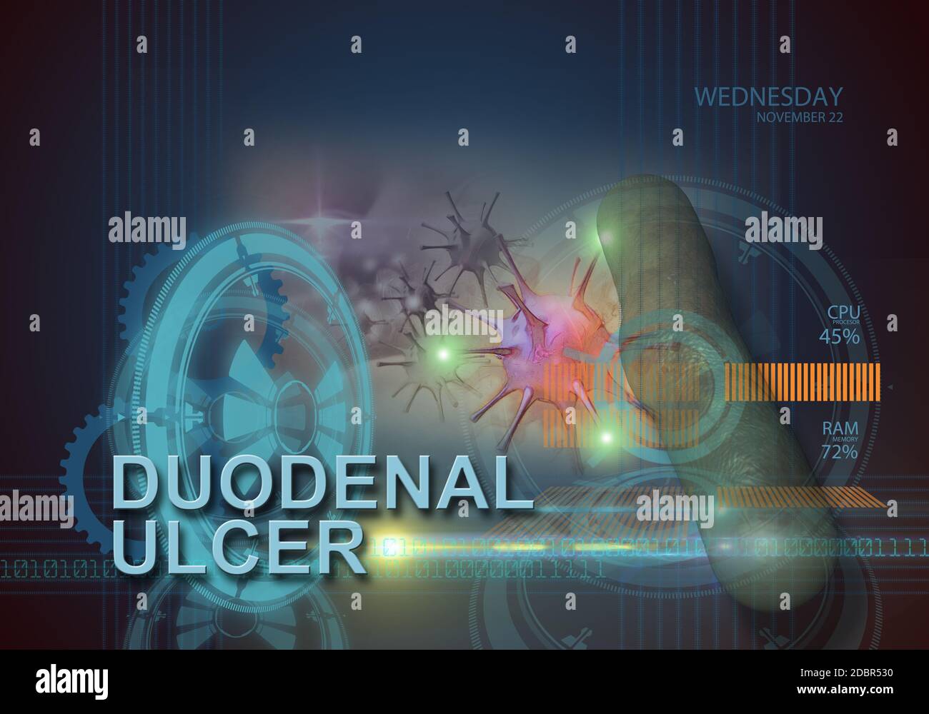 hi tech infographics of duodenal ulcer made in 3d software Stock Photo
