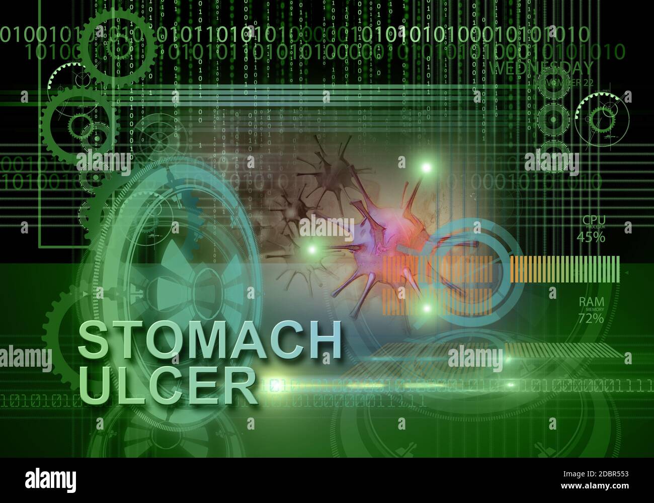 hi tech infographics of stomach ulcer made in 3d software Stock Photo