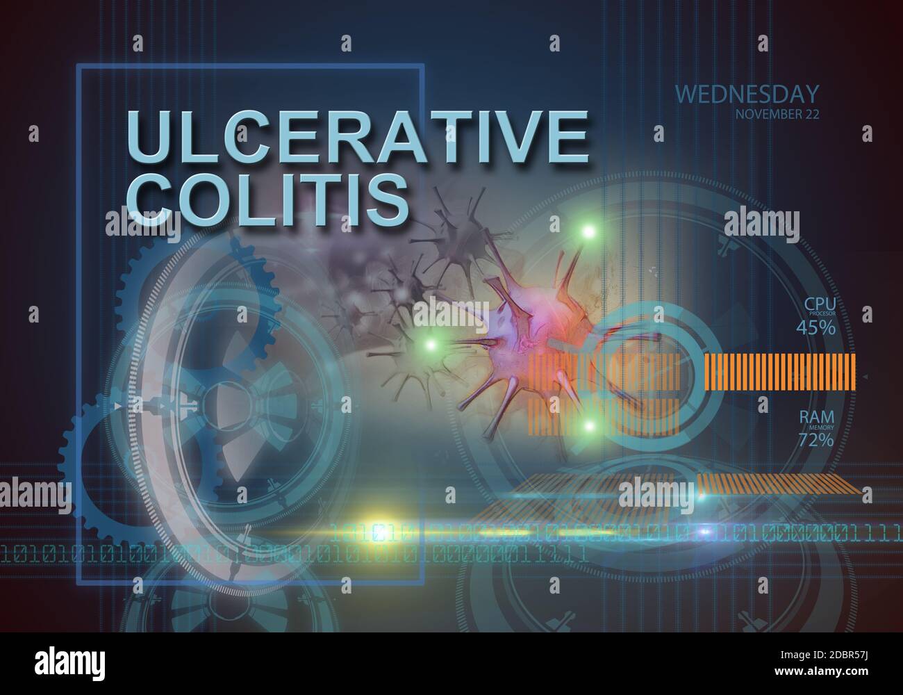 hi tech infographics of ulcerative colitis made in 3d software Stock Photo